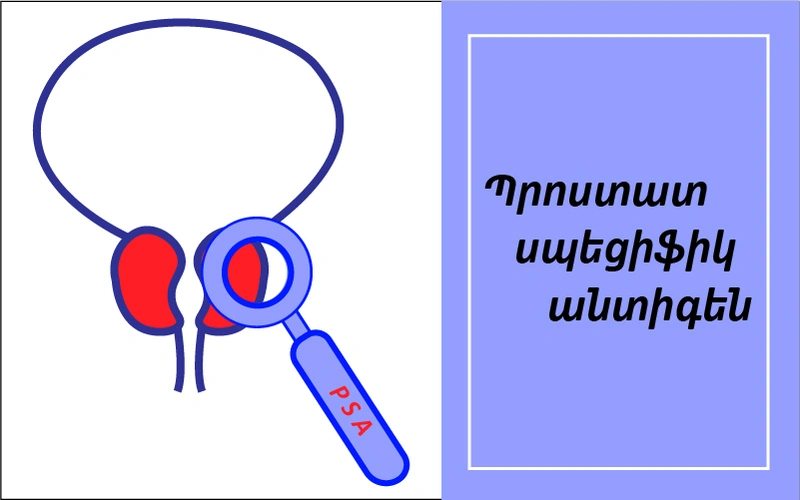 ՊՍԱ, Պրոստատ սպեցիֆիկ անտիգեն